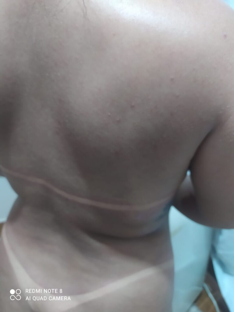 Laurah Bronze - Bronzeamento Artificial