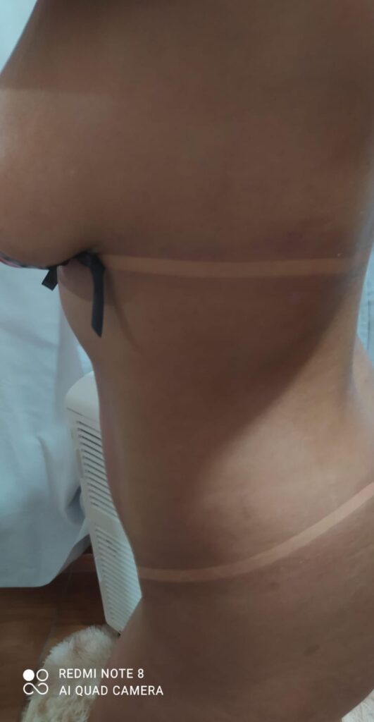 Laurah Bronze - Bronzeamento Artificial